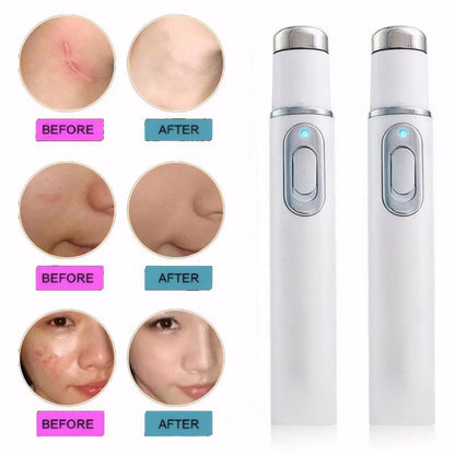Radiance Restore Pen™